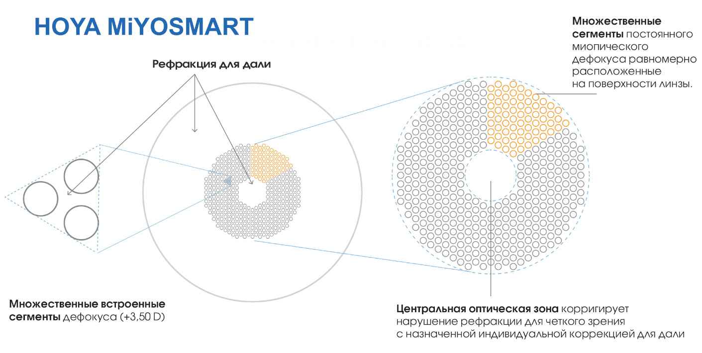 линзы для очков Miyosmart линзы для очков Miyosmart
